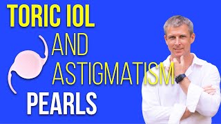 Toric IOLs and astigmatism perls for cataract surgery [upl. by Magnusson545]