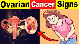 9 Common Ovarian Cancer Signs That You Should Never Ignore [upl. by Novyar]