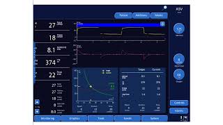 An Overview of Adaptive Support Ventilation ASV [upl. by Winograd]