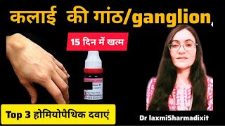 TOP 3 homoeopathic medicines for ganglionWrist cyst [upl. by Huan]