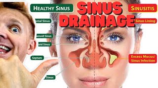 Natural sinus drainage swollen lymph nodes blocks the passage tutorial [upl. by Seto]