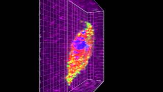 Phenotype of a palladindepleted cell plated in 3D collagen matrix [upl. by Julian208]