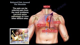 Referred Pain Around The Shoulder  Everything You Need To Know  Dr Nabil Ebraheim [upl. by Nivahb]