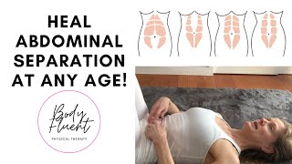 Heal Abdominal Separation At Any Age [upl. by Llewoh]