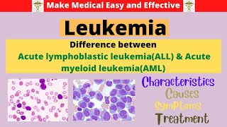 LeukemiaAcute lymphoblastic leukemiaAcute myeloid leukemia Difference bw AML amp ALLBlood cancer [upl. by Gris]