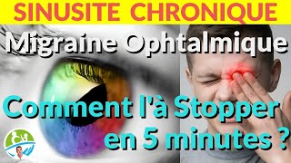 Migraine Ophtalmique Comment là Stopper en 5 minutes ASTUCE [upl. by Annhej]