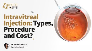 Intravitreal Injection Types Procedure and Cost Dr Anisha Gupta  Eye Specialist Delhi Excel Eye [upl. by Alehtse]