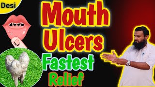 munh ke chhale  How to Heal Mouth Sores Faster  mouth ulcers [upl. by Lobiv]