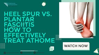 Heel Spur vs Plantar Fasciitis How to Effectively Treat at Home [upl. by Giltzow]