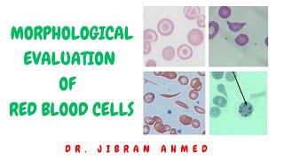 MORPHOLOGICAL EVALUATION OF RED BLOOD CELLS II PRACTICAL PATHOLOGY II DR JIBRAN AHMED [upl. by Idak]