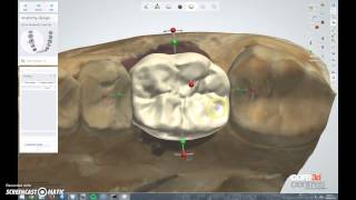 Universal nobel ti base monolithic crown design in 3shape [upl. by Rogerio358]