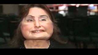 First Face Transplant  What Is The First US Face Transplant Patient Doing Now [upl. by Haskell]