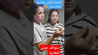 الحصة الأولى عند حنان إزالةالكلف اكسبلور ازالةالتجاعيد تيكتوك ترند tattoo [upl. by Enwad]