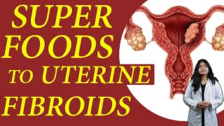 Best Fruits amp Vegetable to UTERINE FIBROIDS  Food to Avoid For Fibroids in Hindi  Dr Mahima [upl. by Sadella914]