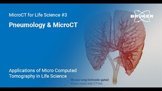 Pneumology amp MicroCT  Applications of MicroCT in Life Science 3 [upl. by Suivatnad]