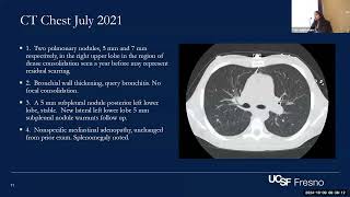 Central Valley Chronicles Challenging Coccidiomycosis Cases in PWH [upl. by Newby]