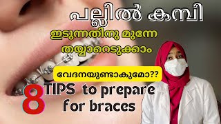 പല്ലിൽ കമ്പി ഇടുന്നതിനു മുന്നേ തയ്യാറെടുക്കാം👍🏻WATCH this dentist malayalam braces [upl. by Htiel861]