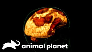 Deathly Parasite Attacks A Toddlers Brain  Monsters Inside Me  Animal Planet [upl. by Eehtomit]