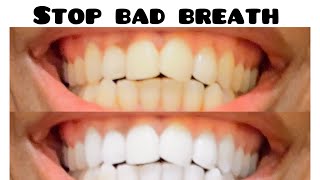 STOP HALITOSIS AND CLEAN YOUR TEETH NATURALLY [upl. by Doria]