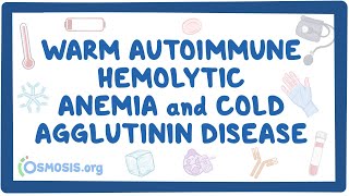 Warm autoimmune hemolytic anemia and cold agglutinin NORD [upl. by Sairahcaz]