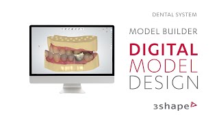 3Shape Dental System  Model Builder  Digital model design [upl. by Seline]