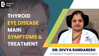 Signs of Thyroid Eye Disease Graves Disease amp Treatment  Dr Divya Sundaresh  Doctors Circle [upl. by Pepillo165]