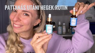 Pattanás utáni hegek Rutin Erenor Cosmetics [upl. by Arela]