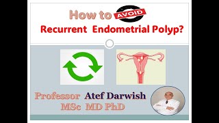 How to avoid Recurrent Endometrial polyp [upl. by Aneekahs361]