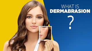 What is Dermabrasion good for  Side Effects and More [upl. by Nahtad920]