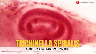 Trichinella spiralis under the microscope [upl. by Aliab]