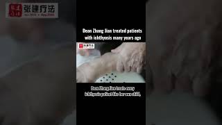 Dean Zhang Jian treated patients with ichthyosis many years ago ichthyosis skincare dryskin [upl. by Vittorio]