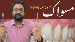 How to Use MISWAK to Heal Gum Recession [upl. by Bazar]