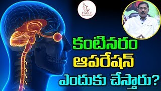 కంటినరం ఆపరేషన్ ఎందుకు చేస్తారు  Why Do We Need Optic Nerve Surgery  Eye Operation  Eagle Health [upl. by Etep]