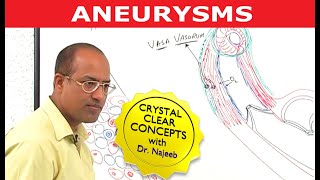 Aneurysms  Causes and Symptoms  Cardiology [upl. by Gathers]