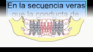 MUELA DEL JUICIO [upl. by Hoxie]