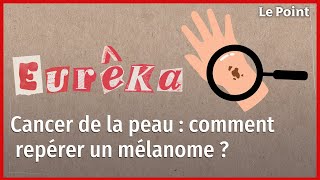 Cancer de la peau  comment se prémunir dun mélanome [upl. by Puto]