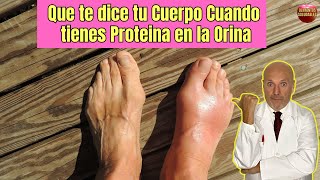 😱 SINTOMAS Y SEÑALES DE PROTEINA EN LA ORINA CON LAS QUE TE AVISA TU CUERPO 😱 [upl. by Adnileb459]