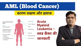 Acute Myeloid Leukemia AML Cause Symptoms Tests and Treatment Explained  Blood Cancer [upl. by Hamish]