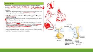 Hypopituitarism  Endocrine System  Step 1 Simplified [upl. by Dweck347]