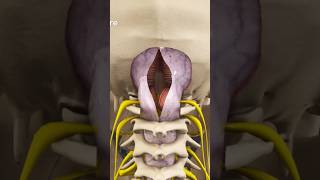 Chiari Decompression Surgery [upl. by Lusty]