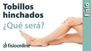 ¿Tienes los tobillos y piernas hinchadas  ¿Será edema venoso o linfático [upl. by Korey772]