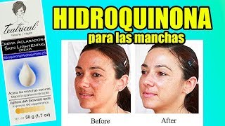 Crema hidroquinona para manchas en la cara [upl. by Adnek]