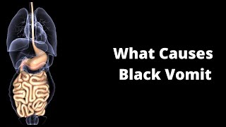 What Causes Black Vomit [upl. by Haelahk]