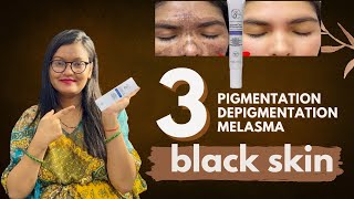 S for Skin Depigmentation cream  इतने सारे claim 😱 [upl. by Mabel]