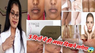 Ethiglo Soap Honest ReviewEthiglo Soap ph TestEthiglo Soap Benefits Usesampside effects review hindi [upl. by Sherri500]