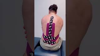 ATHLETIC TAPING FOR LOW BACK PAIN🩹 [upl. by Hooper]