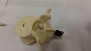 Typical Vertebra Parts 1 of 2 [upl. by Bruyn]