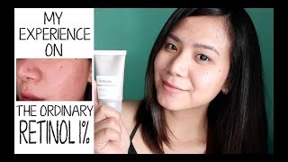 The Ordinary Retinol 1  1 Month Usage  Anna Tomo Philippines [upl. by Syd]