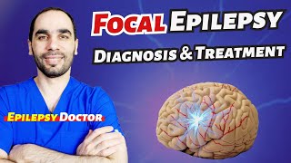 Focal or Partial Epilepsy Diagnosis and Treatment [upl. by Aciraj57]