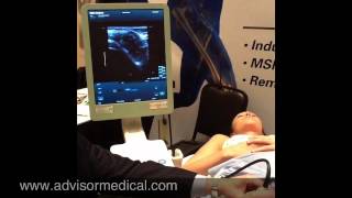 Ultrasound Guided Hip Injection [upl. by Parik]